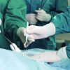 عمل بواسیر و جراحی هموروئید + روش های سرپایی و بدون درد جراحی بواسیر