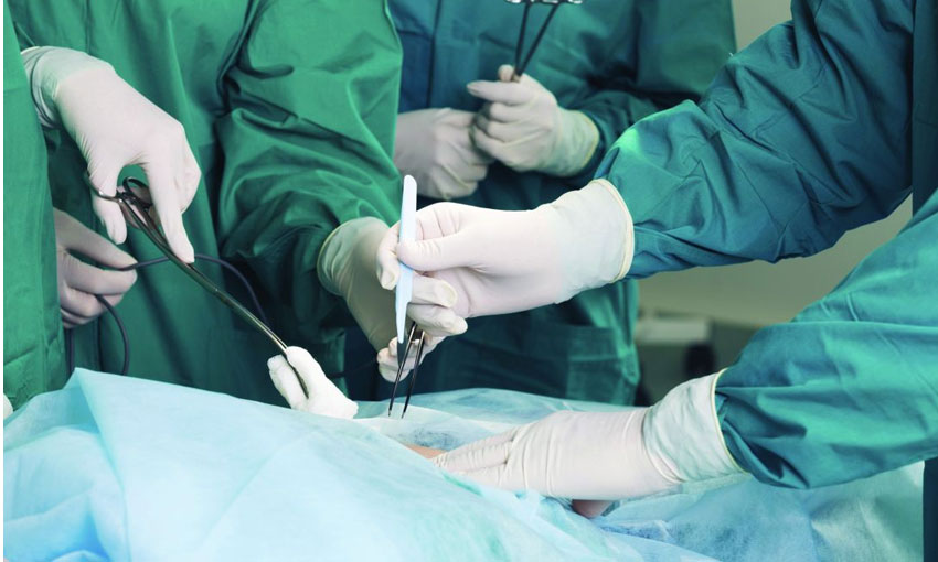 عمل بواسیر و جراحی هموروئید + روش های سرپایی و بدون درد جراحی بواسیر
