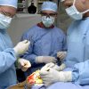 عمل جراحی کیست مویی[باز-بسته] “سرپایی” بدون بازگشت