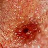 زخم شکم ؛ دلایل، علائم، درمان خانگی و پیشگیری