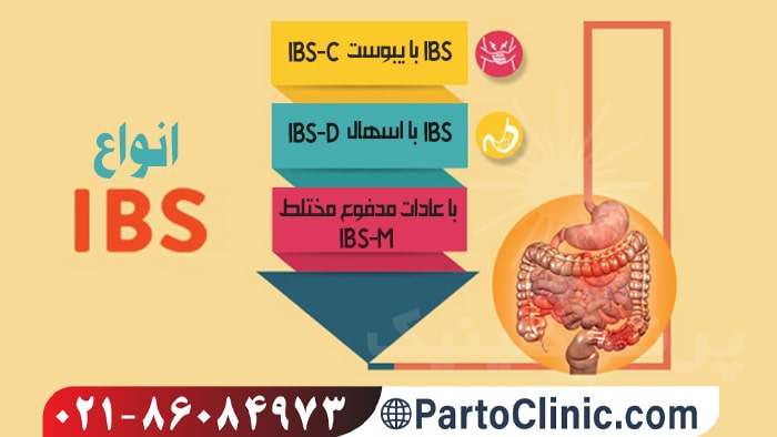 انواع IBS