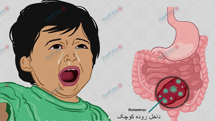 روتاویروس