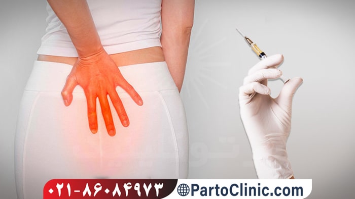 بوتاکس برای شقاق مقعدی