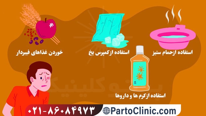 درمان خانگی شقاق