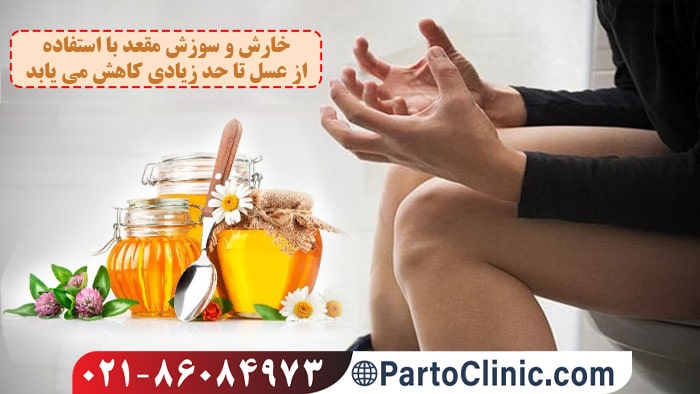 تاثیر عسل در درمان شقاق