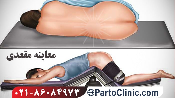 تشخیص فیشر