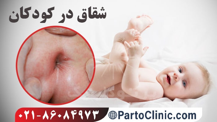 علت ایجاد شقاق در کودکان
