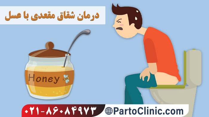 نحوه استفاده از عسل برای شقاق