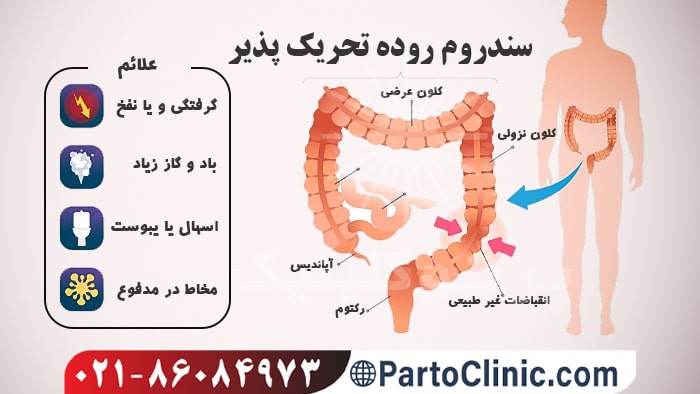 علائم سندروم روده