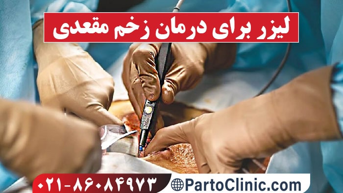 لیزر زخم مقعدی