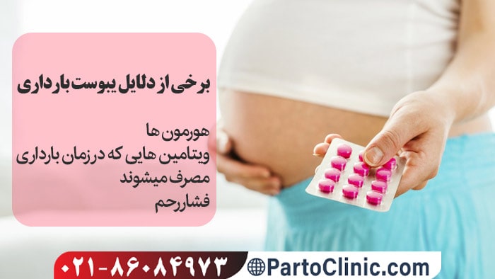 علت یبوست در بارداری