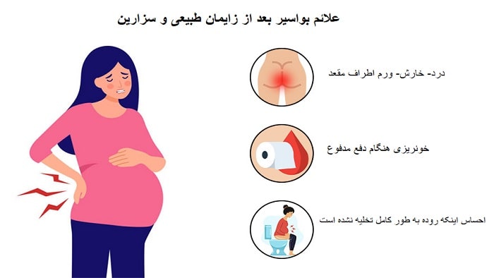 علائم بواسیر بعد از زایمان