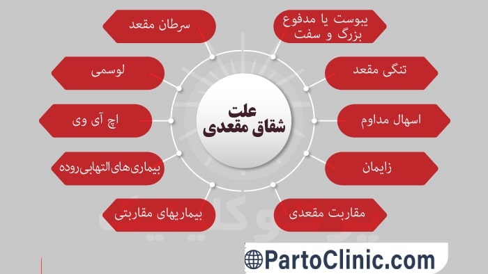 علت شقاق مقعدی چیست