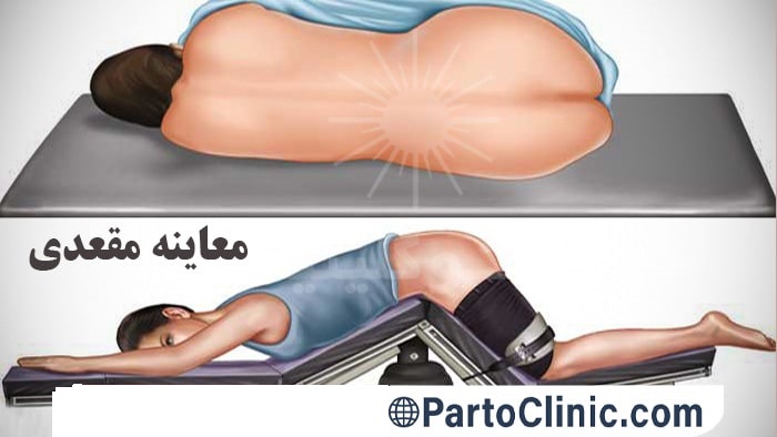 تشخیص فیشر