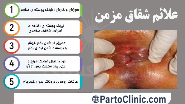علائم شقاق مزمن